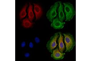 ABIN7094768 and ABIN7098819 staining Hela cells by IF/ICC.
