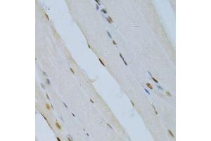 Immunohistochemistry (Paraffin-embedded Sections) (IHC (p)) image for anti-Mitogen-Activated Protein Kinase 3 (MAPK3) (AA 1-100) antibody (ABIN3020725)