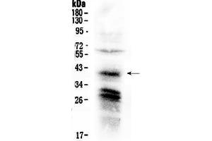 Western blot analysis of CXCR4 using anti-CXCR4 antibody . (CXCR4 antibody  (C-Term))