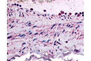 Immunohistochemical (Formalin/PFA-fixed paraffin-embedded sections) staining in human vascular smooth muscle with PTPMT1 polyclonal antibody . (PTPMT1 antibody)