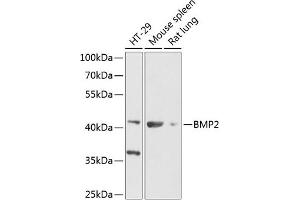 Western blot analysis of extracts of various cell lines, using BMP2 Antibody (ABIN6127494, ABIN6137595, ABIN6137596 and ABIN6216531) at 1:1000 dilution. (BMP2 antibody  (AA 1-100))