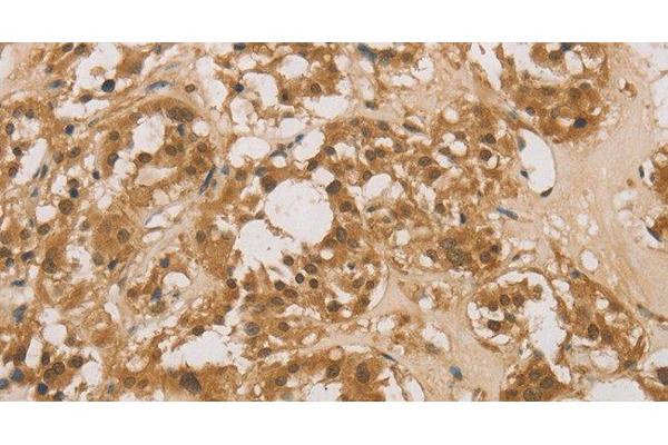 DACH1 antibody