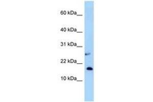 Image no. 1 for anti-Nudix (Nucleoside Diphosphate Linked Moiety X)-Type Motif 15 (NUDT15) (AA 33-82) antibody (ABIN6748042) (NUDT15 antibody  (AA 33-82))