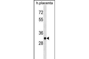 ZN Antibody (N-term) (ABIN1538903 and ABIN2838229) western blot analysis in human placenta tissue lysates (35 μg/lane). (ZNF783 antibody  (N-Term))
