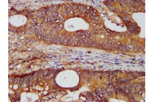 Immunohistochemistry (IHC) image for anti-Kinectin 1 (Kinesin Receptor) (KTN1) (AA 978-1116) antibody (ABIN7157562)