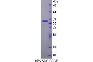 Image no. 1 for Calcyclin Binding Protein (CACYBP) (AA 2-228) protein (His tag) (ABIN6236860) (CACYBP Protein (AA 2-228) (His tag))