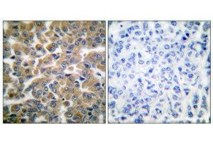 Immunohistochemistry (IHC) image for anti-GR (Internal Region), (pSer211) antibody (ABIN1847912) (GR (Internal Region), (pSer211) antibody)