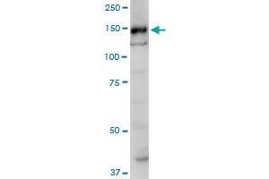 SRGAP1 monoclonal antibody (M07), clone 5D10. (SRGAP1 antibody  (AA 952-1050))