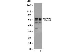 Western blot testing of Lamin A/C antibody and Lane 1:  HeLa;  2: A431 cell lysate (Lamin A/C antibody  (AA 455-469))