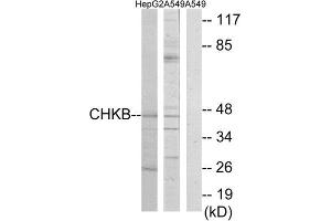 Western Blotting (WB) image for anti-Choline Kinase beta (CHKB) (C-Term) antibody (ABIN1850102) (CHKB antibody  (C-Term))
