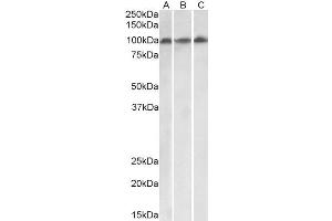 ABIN4902793 (0. (VPS16 antibody  (Isoform 1))