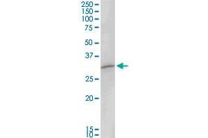 MAGEA8 MaxPab rabbit polyclonal antibody. (MAGEA8 antibody  (AA 1-318))