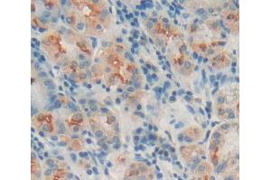 Used in DAB staining on fromalin fixed paraffin- embedded stomach tissue (MPP3 antibody  (AA 385-570))