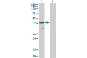 Western Blot analysis of VPS26A expression in transfected 293T cell line by VPS26A monoclonal antibody (M02), clone 1C4.