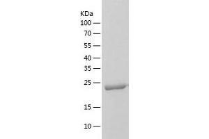 Western Blotting (WB) image for ClpP Caseinolytic Peptidase, ATP-Dependent, Proteolytic Subunit Homolog (E. Coli) (CLPP) (AA 57-277) protein (His tag) (ABIN7287371) (CLPP Protein (AA 57-277) (His tag))