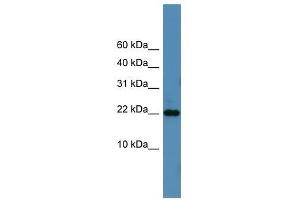 Western Blot showing SFRS12IP1 antibody used at a concentration of 1-2 ug/ml to detect its target protein.