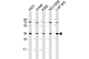 All lanes : Anti-ETV7 Antibody (C-term) at 1:2000 dilution Lane 1: A431 whole cell lysate Lane 2: Jurkat whole cell lysate Lane 3: K562 whole cell lysate Lane 4: NCI- whole cell lysate Lane 5: U-87 MG whole cell lysate Lysates/proteins at 20 μg per lane.