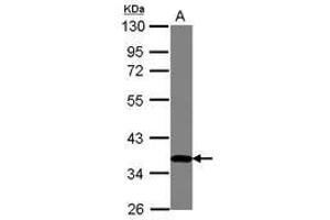 Image no. 1 for anti-Zinc Finger Protein 177 (ZNF177) (AA 113-301) antibody (ABIN1501828) (ZNF177 antibody  (AA 113-301))
