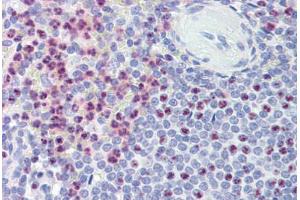 Spleen, Human: Formalin-Fixed, Paraffin-Embedded (FFPE) (PKD1 antibody  (AA 4289-4300))