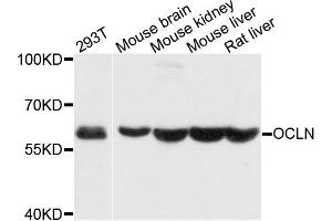 Western blot analysis of extracts of various cells, using OCLN antibody. (Occludin antibody)
