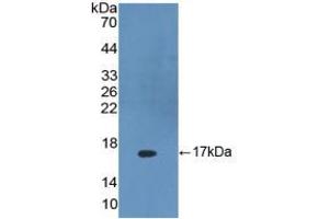 Figure. (DKK4 antibody  (AA 107-212))