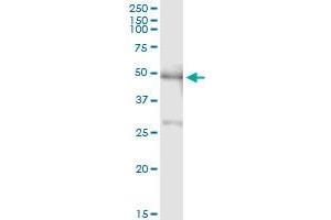Immunoprecipitation of PBX2 transfected lysate using anti-PBX2 MaxPab rabbit polyclonal antibody and Protein A Magnetic Bead , and immunoblotted with PBX2 monoclonal antibody (M01), clone 2E9 . (PBX2 antibody  (AA 1-430))