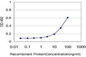 Detection limit for recombinant GST tagged IL18BP is approximately 3ng/ml as a capture antibody. (IL18BP antibody  (AA 31-194))