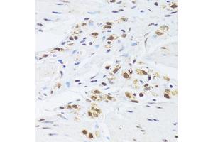 Immunohistochemistry of paraffin-embedded human stomach using GABPB1 Antibody (ABIN2562720) at dilution of 1:100 (40x lens). (GABPB1 antibody)