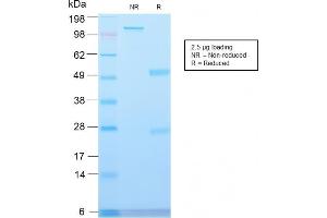 SDS-PAGE Analysis Major Vault Protein Rabbit Recombinant Monoclonal Antibody (VP2897R). (Recombinant MVP antibody)