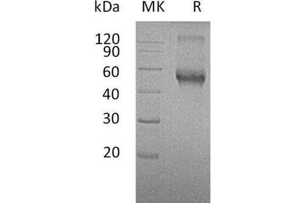 ACVRL1 Protein (Fc Tag)