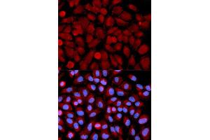 Immunofluorescence analysis of U2OS cell using MAPK9 antibody. (JNK2 antibody  (AA 1-424))