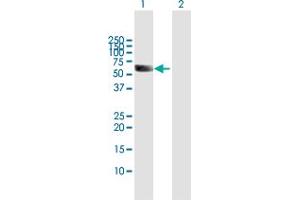 Western Blot analysis of UGT1A9 expression in transfected 293T cell line by UGT1A9 MaxPab polyclonal antibody.