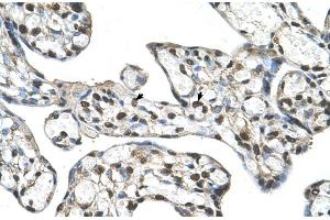 Human Placenta (FLJ20489 (C-Term) antibody)