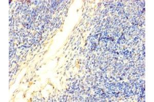 Immunohistochemistry of paraffin-embedded human thymus tissue using DNTT antibody at dilution of 1:100. (TdT antibody  (AA 1-509))