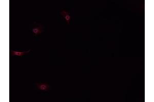ABIN6268914 staining MCF-7 cells by IF/ICC.