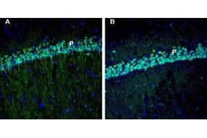 Expression of EphA3 in rat and mouse hippocampus - Immunohistochemical staining of perfusion-fixed frozen rat and mouse brain sections with Anti-EphA3 (extracellular) Antibody (ABIN7043123, ABIN7044245 and ABIN7044246), (1:200), followed by goat anti-rabbit-AlexaFluor-488.