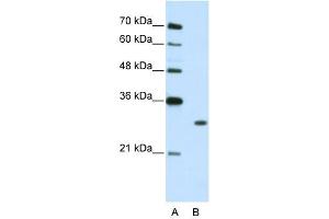WB Suggested Anti-MBNL1  Antibody Titration: 2. (MBNL1 antibody  (C-Term))