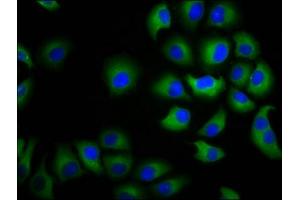 CHST3 antibody  (AA 316-427)