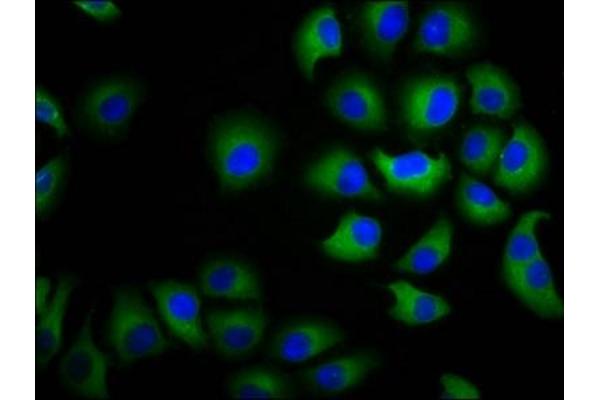 CHST3 antibody  (AA 316-427)