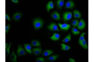 Immunofluorescence staining of A549 cells with ABIN7146688 at 1:100, counter-stained with DAPI. (CHST3 antibody  (AA 316-427))