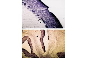 Immunohistochemistry (IHC) image for anti-Inositol 1,4,5-Trisphosphate Receptor, Type 1 (ITPR1) (AA 2732-2750), (Intracellular) antibody (ABIN7043287)