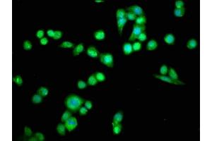 Immunofluorescence staining of PC-3 cells with ABIN7164696 at 1:66, counter-stained with DAPI. (PDCD6 antibody  (AA 1-191))