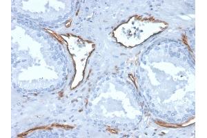 Immunohistochemistry (IHC) image for anti-Platelet/endothelial Cell Adhesion Molecule (PECAM1) (AA 625-738) antibody (ABIN6940277)