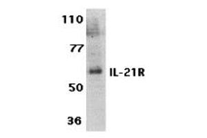 Western Blotting (WB) image for anti-Interleukin 21 Receptor (IL21R) (Extracellular Domain) antibody (ABIN1030836) (IL21 Receptor antibody  (Extracellular Domain))