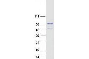Western Blotting (WB) image for Ubiquitin Specific Peptidase 21 (USP21) (Transcript Variant 1) protein (Myc-DYKDDDDK Tag) (ABIN2735101)