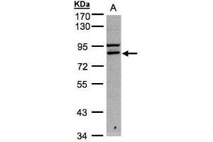 WB Image Sample A: 30μg of Hep G2 whole cell lysate , 7. (FASTKD1 antibody)