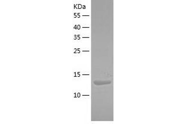 PLA2G5 Protein (AA 21-137) (His tag)