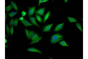 Immunofluorescence staining of Hela Cells with ABIN7127669 at 1:50, counter-stained with DAPI. (Recombinant PCYT1A antibody)