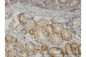 Immunoperoxidase of monoclonal antibody to TLN1 on formalin-fixed paraffin-embedded human small Intestine. (TLN1 antibody  (AA 1052-1149))