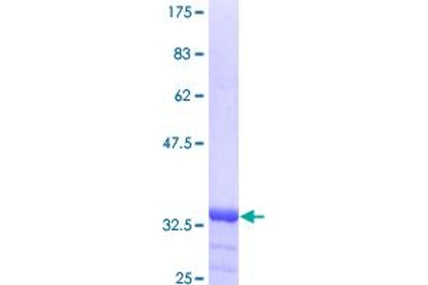 Inversin Protein (INVS) (AA 1-101) (GST tag)